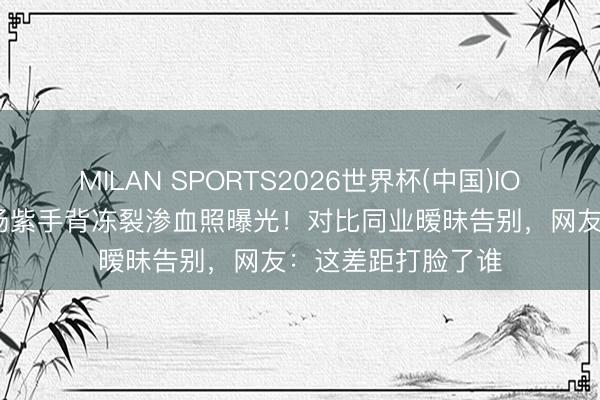 MILAN SPORTS2026世界杯(中国)IOS/安卓官方下载 杨紫手背冻裂渗血照曝光！对比同业暧昧告别，网友：这差距打脸了谁